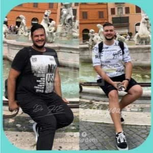 gastric sleeve before after 1