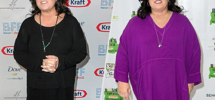 Rosie O’Donnell’s Gastric Sleeve