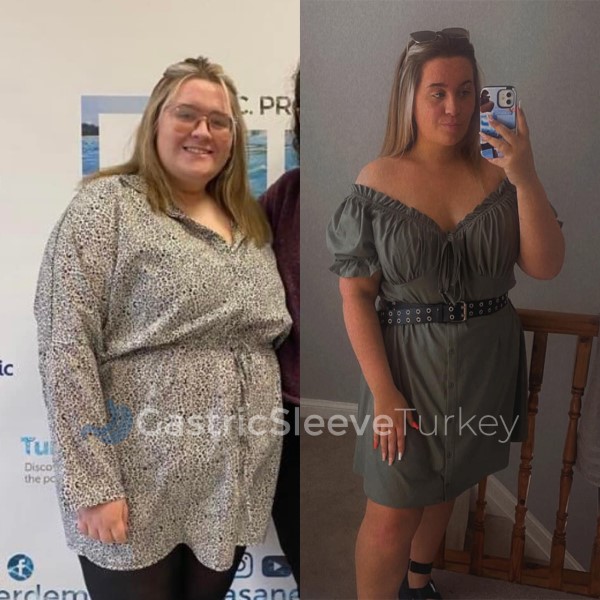 BMI Calculator